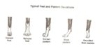 DP Feet Pastern deviations.jpg